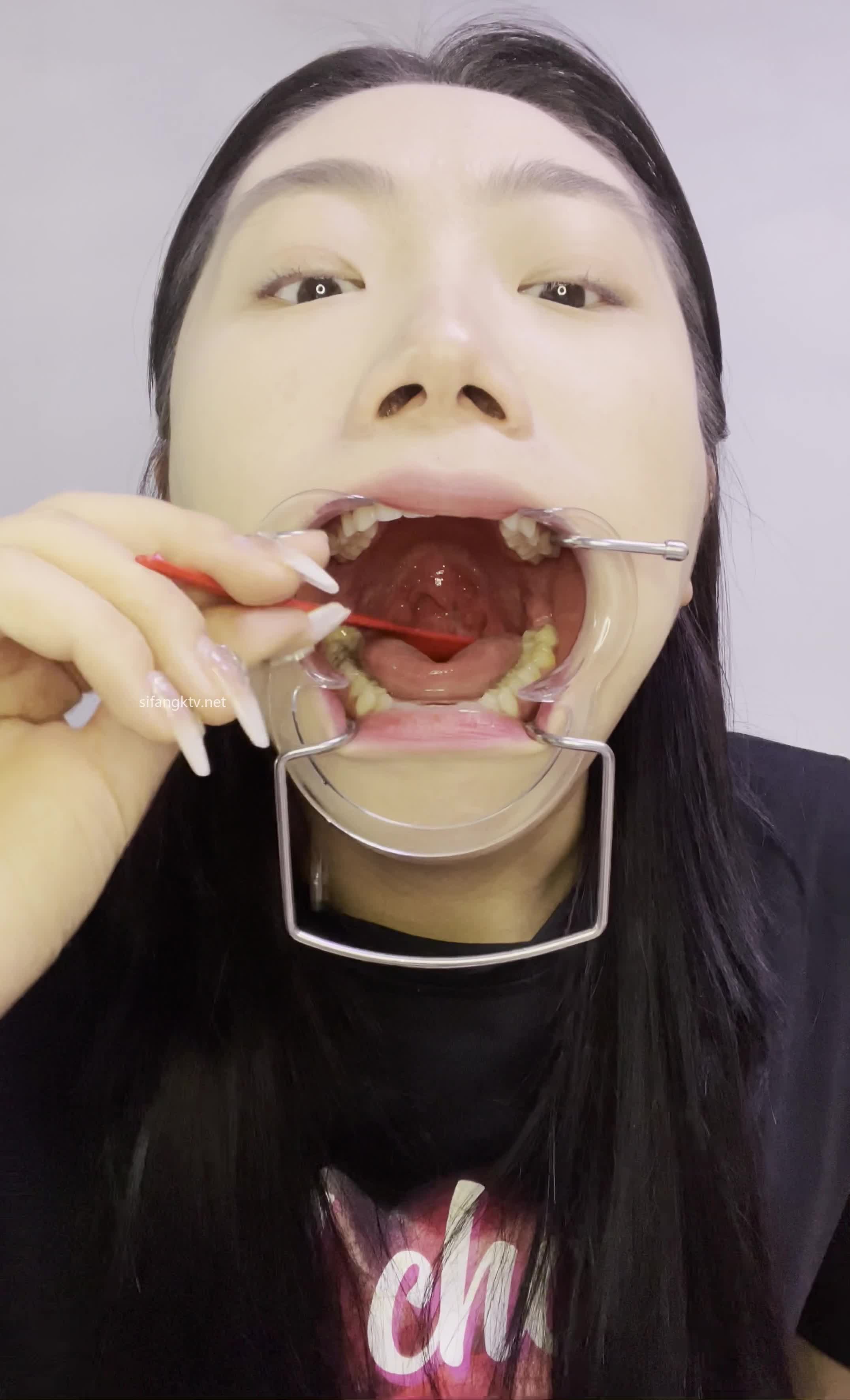 2 (34)