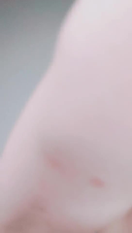  (4)